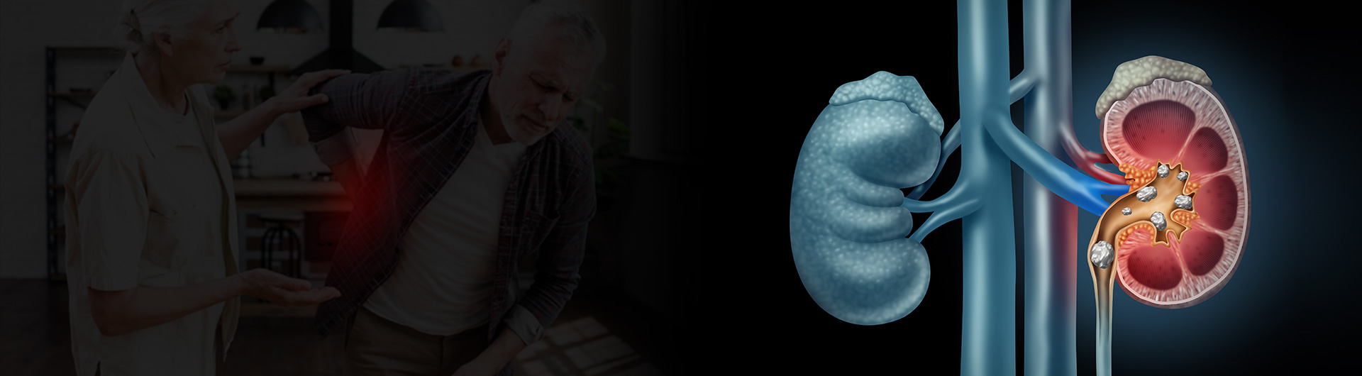 मुतखडा उपचार – जाणून घ्या कारण आणि प्रकार